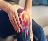 4 مراحل للإصابة بخشونة الركبة تعرف عليها