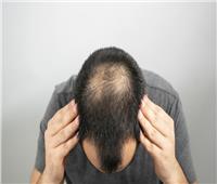 دواء شائع لعلاج تساقط الشعر وتضخم البروستات يظهر فائدة أخرى 