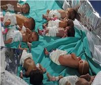 مسئول أممي يؤكد عدم وجود «مواليد بحجم طبيعي» في قطاع غزة