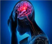 دراسة: فصيلة الدم قد تؤثر على خطر الإصابة بالسكتة الدماغية  