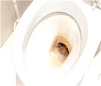 «بملعقتين وفي 15 دقيقة».. طريقة إزالة الترسبات الكلسية من المرحاض