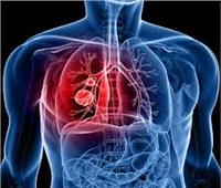 دراسة جديدة تربط السجائر الالكترونية بالإصابة بسرطان الرئة