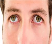 التغلب على رأرأة العين.. استراتيجيات فعالة لعلاج الاضطراب البصري