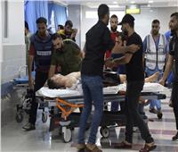 مستشفى شهداء الأقصى تتسلم 141 شهيدًا و380 مصابًا فلسطينيًا خلال 24 ساعة