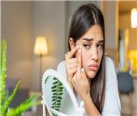 بمكونات المطبخ.. طريقة علاج حب الشباب