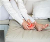استشاري التغذية العلاجية| نصائح غذائية لتحسين نوعية الحياة لمرضى النقرس