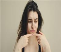 من حب الشباب للعقم.. التأثير الخفي لمتلازمة تكيس المبايض