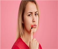 «لو مش بتحب الطحينة».. علاجات منزلية لعلاج تقرحات الفم 