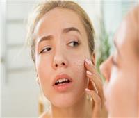 5 ممارسات يومية بسيطة لتحسين صحة البشرة وإشراقها