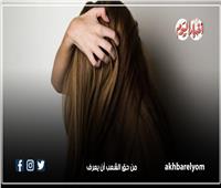 إنفوجراف| لو زارع شعرك.. 6 طرق لحمايته من الهواء الجاف والقشرة