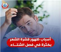 الصحة تكشف أسباب ظهور قشرة الرأس في فصل الشتاء