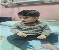 إجراء أول جراحة قلب مفتوح لطفل من غزة بمستشفى أبوالريش الياباني