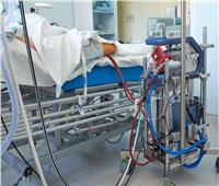 دراسة.. 56% من مرضى COVID-19 على جهاز ECMO يفقدون حياتهم بالمستشفى 