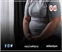 إنفوجراف| 6 مضاعفات صحية تسببها السمنة وزيادة الوزن