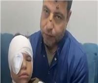 ‏«رشق قطار أشمون بالحجارة وصغيرة تفقد عينها».. تحرك حكومي سريع وبيان للنقل