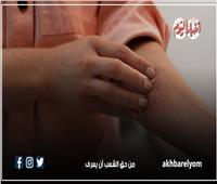 لصحتك.. ما يجب فعله للوقاية من خطر سرطان الجلد