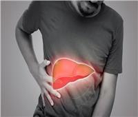 أمراض الكبد.. الأسباب والأعراض وطرق الوقاية