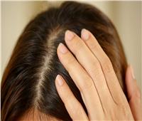 3 مكونات طبيعية تساعدك على التخلص من قشرة الشعر