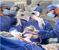  نجاح أول عملية استئصال ورم بتقنية الجراحة الواعية بجامعة قناة السويس