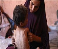 الأمم المتحدة: 500 ألف شخص من سكان غزة يواجهون جوعًا كارثيًا