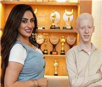 أول ظهور إعلامي.. داليا الخطيب تستضيف بطل «ضي»