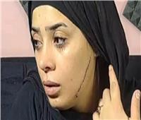 تأجيل محاكمة المتهمة بتشويه وجه عروس مصر القديمة بـ41 غرزة