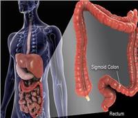 اضطراب غير مرئي| ماهي متلازمة فرط نمو البكتيريا بالأمعاء الدقيقة؟