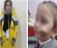نقل حضانة صغيرة عذبتها والدتها بكفر الشيخ إلى الجدة