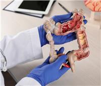 دراسة علمية توضح مشروب شائع يضاعف من خطر سرطان الأمعاء