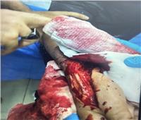 البحث عن المتهمين بالتعدي على شاب بسلاح أبيض بحلوان 