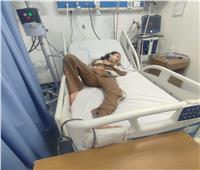 عميد «طب طنطا» يوضح آخر تفاصيل الحالة الصحية لـ«طفلة البالونة»