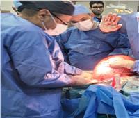 استئصال ورم وزنة 23 كيلو جراماً من جسد مريض بدمياط
