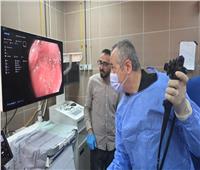 إطلاق خدمة منظار الجهاز الهضمي المُكبر بمستشفى أحمد ماهر التعليمي