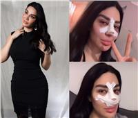 بعد أزمة تنفس وعملية في الوجه.. سارة نخلة تكشف تطورات حالتها الصحية وتفاصيل التعافي