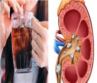 احذر.. مشروبات تضر بصحة الكلى ونصائح للحفاظ عليها