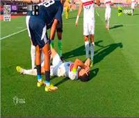 الزمالك يعلن تفاصيل إصابة عمر جابر في لقاء إنبي 