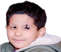ياسين .. أصغر ضحية المــراهنـــات
