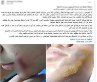 الداخلية تكشف ملابسات اعتداء طفل على زميله بقطعة زجاج في البحيرة