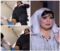 خاص| فيفي عبده بين العلاج والجبس.. هل تدخل غرفة العمليات؟
