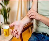 دراسة.. حك لدغات البعوض يزيد الالتهاب لكنه قد يحمل فائدة غير متوقعة