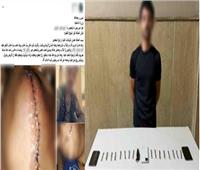 الداخلية تكشف ملابسات الاعتداء على سيدة بسلاح أبيض في كفر الشيخ