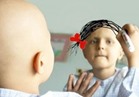 ارتفاع سرطان الأطفال بنسبة 13% خلال 20 عاما