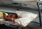 الصليب الأحمر: ارتفاع قتلى تفشي الكوليرا في اليمن إلى 180